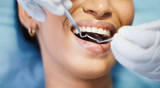 Best Dentist for Tooth Abscess  in Beavercreek, OH